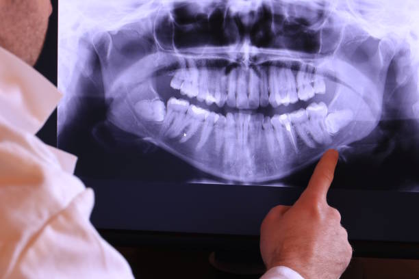 Best After-Hours Emergency Dentist in Hackettstown, NJ