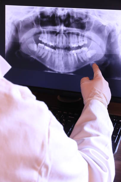 Best Emergency Tooth Extraction in Hackettstown, NJ